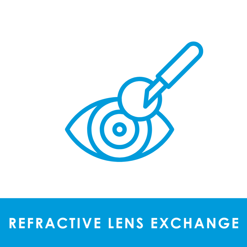 Refractive Lens Exchange