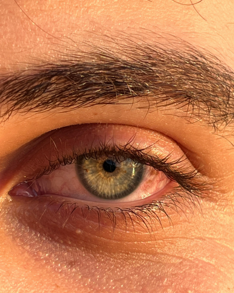Close-up photo of a healthy hazel-green eye with visible iris detail, eyelashes, and natural sunlight highlighting the eye surface and surrounding skin.